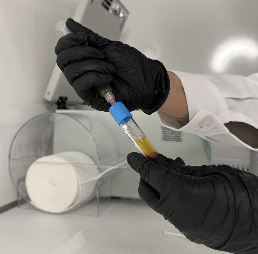Lab technician using syringe to fill blood sample tube, showcasing medical testing procedure.